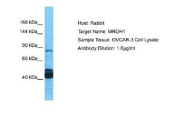 HEATR7A Rabbit anti-Human, Polyclonal, Novus Biologicals 0.1 mL | Buy Online | Novus Biologicals | Fisher Scientific